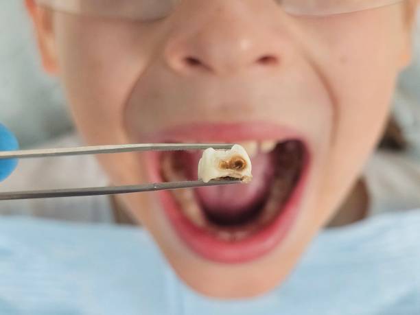 Best Emergency Dental Care for Sports Injuries in Kentfield, CA